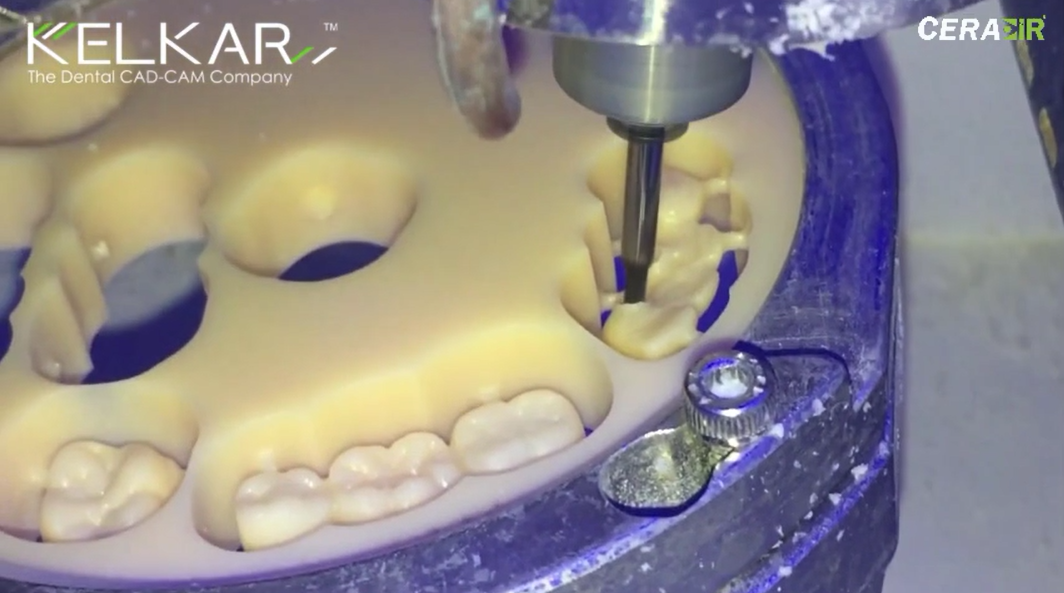 KELKAR ivoryMill 5XW dental milling machine - Abutment Bridge in PMMA